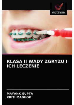 Klasa Ii Wady Zgryzu I Ich Leczenie