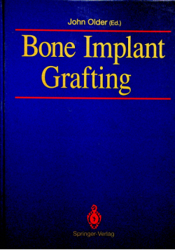 Bone Implant Grafting