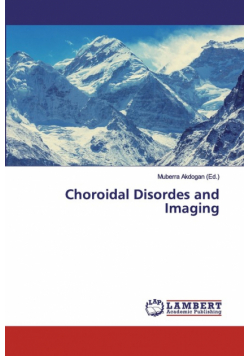 Choroidal Disordes and Imaging