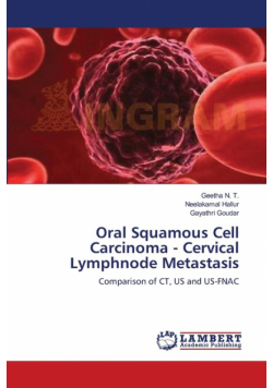 Oral Squamous Cell Carcinoma - Cervical Lymphnode Metastasis