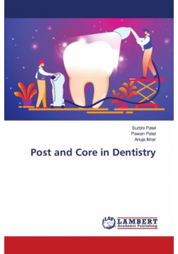 Post and Core in Dentistry