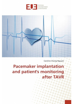 Pacemaker implantation and patient's monitoring after TAVR