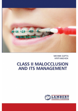 Class Ii Malocclusion And Its Management