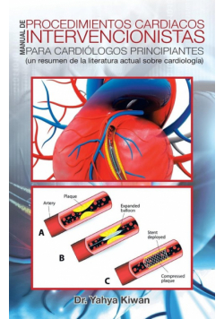 Manual de procedimientos cardiacos intervencionistas para cardiólogos principiantes