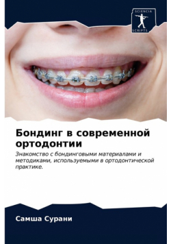 Бондинг в современной ортодонтии