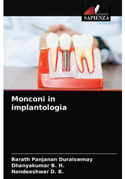 Monconi in implantologia