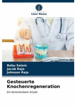 Gesteuerte Knochenregeneration