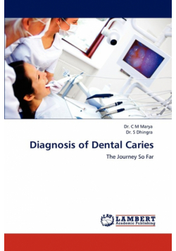 Diagnosis of Dental Caries