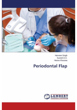 Periodontal Flap