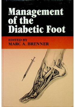 Management of the diabetic foot