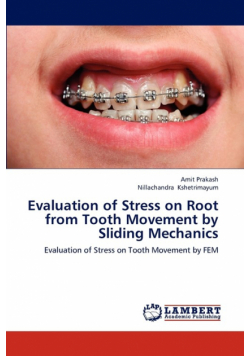 Evaluation of Stress on Root from Tooth Movement by Sliding Mechanics