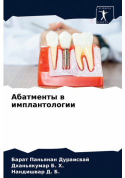 Абатменты в имплантологии