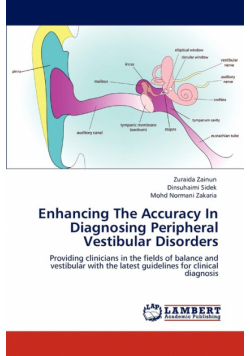 Enhancing The Accuracy In Diagnosing Peripheral Vestibular Disorders