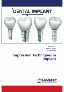 Impression Techniques in Implant