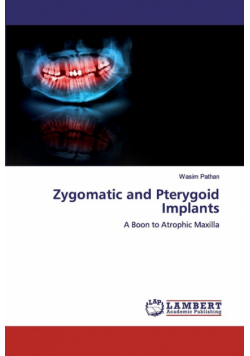 Zygomatic and Pterygoid Implants