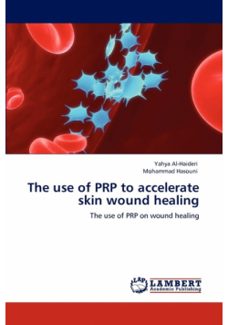 The use of PRP to accelerate skin wound healing