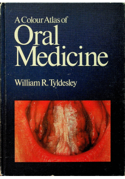A Colour Atlas of Oral Medicine