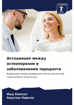 Ассоциация между остеопорозом и заболеваниями пародонта