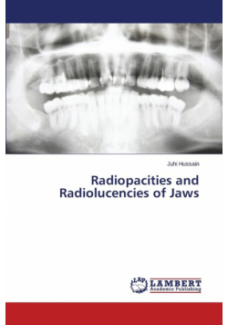 Radiopacities and Radiolucencies of Jaws