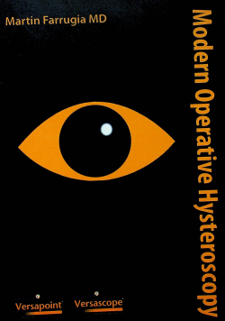 Modern Operative Hysteroscopy