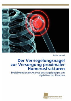 Der Verriegelungsnagel zur Versorgung proximaler Humerusfrakturen
