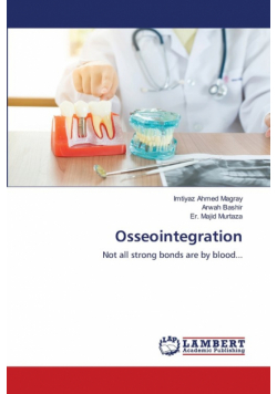 Osseointegration