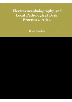 Electroencephalography and Local Pathological Brain Processes. Atlas.