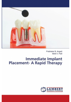 Immediate Implant Placement- A Rapid Therapy