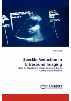 Speckle Reduction in Ultrasound Imaging