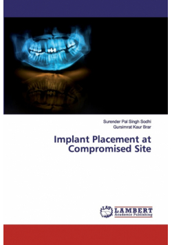 Implant Placement at Compromised Site