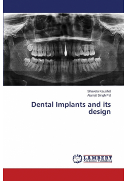 Dental Implants and Its Design