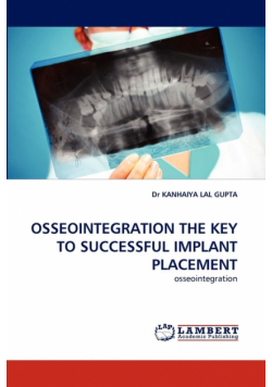 Osseointegration the Key to Successful Implant Placement