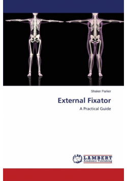 External Fixator