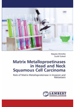 Matrix Metalloproetinases in Head and Neck Squamous Cell Carcinoma