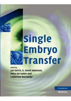 Single Embryo Transfer