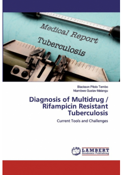Diagnosis of Multidrug / Rifampicin Resistant Tuberculosis