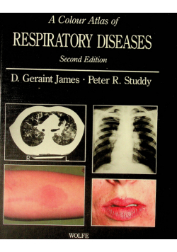A colour atlas of respiratory diseases