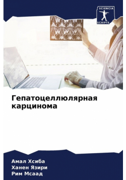 Гепатоцеллюлярная карцинома