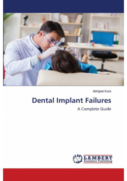 Dental Implant Failures