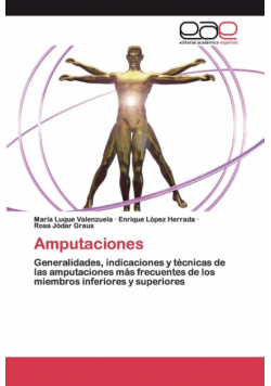 Amputaciones