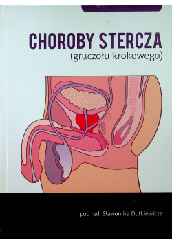 Choroby stercza gruczołu krokowego