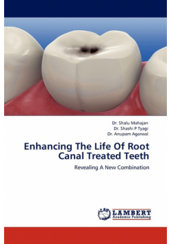 Enhancing The Life Of Root Canal Treated Teeth