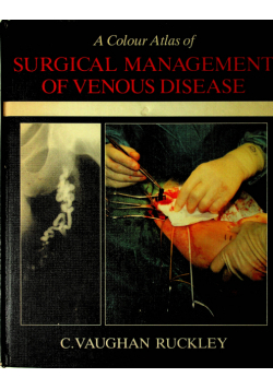 A Colour Atlas of Surgical managenet of Venous Disase