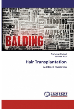 Hair Transplantation