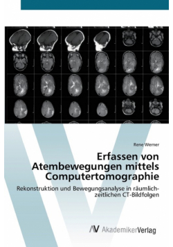 Erfassen von Atembewegungen mittels Computertomographie