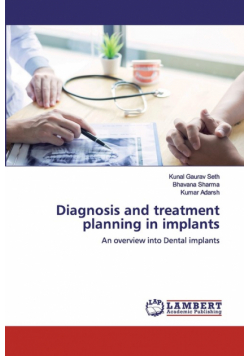 Diagnosis and treatment planning in implants