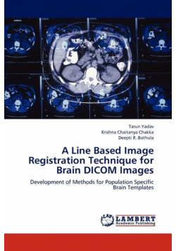 A Line Based Image Registration Technique for Brain Dicom Images