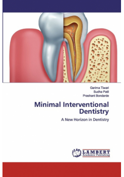 Minimal Interventional Dentistry