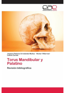 Torus Mandibular y Palatino