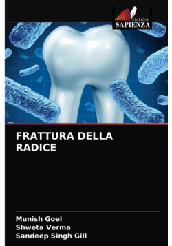 Frattura Della Radice